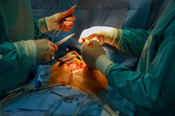 bariatric surgery in Abu Dhabi