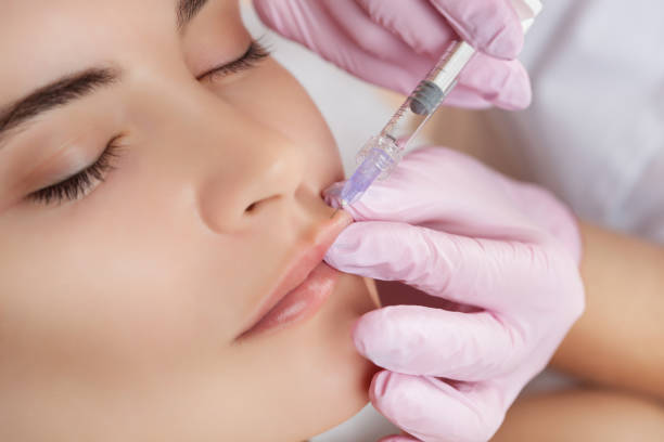 Lip Fillers Injection in Abu Dhabi