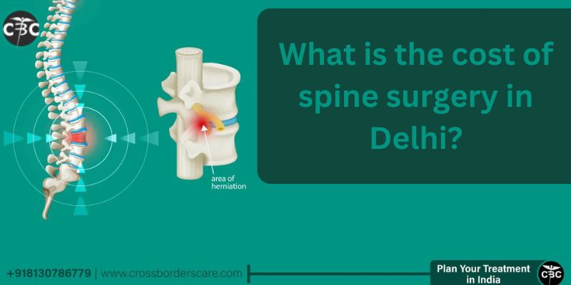 Cost of spine surgery in Delhi